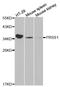 Serine Protease 1 antibody, STJ25163, St John