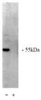 Protein Phosphatase 2 Scaffold Subunit Abeta antibody, AP05041PU-N, Origene, Western Blot image 