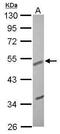 EGF Containing Fibulin Extracellular Matrix Protein 1 antibody, PA5-34788, Invitrogen Antibodies, Western Blot image 