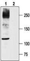 Sodium Voltage-Gated Channel Alpha Subunit 10 antibody, TA329039, Origene, Western Blot image 