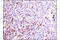 Bruton Tyrosine Kinase antibody, 8547S, Cell Signaling Technology, Immunohistochemistry paraffin image 