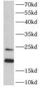 ADP Ribosylation Factor Like GTPase 2 antibody, FNab00574, FineTest, Western Blot image 