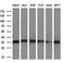 DHEA-ST antibody, GTX83540, GeneTex, Western Blot image 