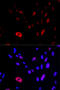 HUS1 Checkpoint Clamp Component antibody, 19-646, ProSci, Immunofluorescence image 