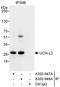 Ubiquitin C-Terminal Hydrolase L3 antibody, A302-947A, Bethyl Labs, Immunoprecipitation image 