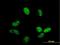 Zinc Finger CCCH-Type Containing 14 antibody, H00079882-B01P, Novus Biologicals, Immunocytochemistry image 