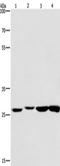 Kruppel Like Factor 7 antibody, TA349370, Origene, Western Blot image 