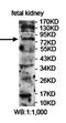 Epidermal growth factor receptor substrate 15-like 1 antibody, orb78307, Biorbyt, Western Blot image 