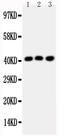 C-C chemokine receptor type 4 antibody, PA1516, Boster Biological Technology, Western Blot image 
