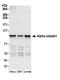 Adaptor Related Protein Complex 2 Subunit Alpha 1 antibody, A304-721A, Bethyl Labs, Western Blot image 