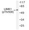 LIM Domain Kinase 1 antibody, AP01627PU-N, Origene, Western Blot image 
