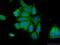 Acidic Residue Methyltransferase 1 antibody, 25124-1-AP, Proteintech Group, Immunofluorescence image 
