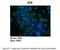 Zinc Finger E-Box Binding Homeobox 1 antibody, ARP30976_P050, Aviva Systems Biology, Immunohistochemistry paraffin image 