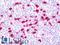 ATP Binding Cassette Subfamily C Member 10 antibody, LS-B11454, Lifespan Biosciences, Immunohistochemistry paraffin image 