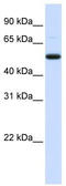 Decapping MRNA 2 antibody, TA344008, Origene, Western Blot image 