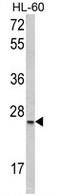 Serine And Arginine Rich Splicing Factor 1 antibody, AP17742PU-N, Origene, Western Blot image 