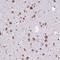 Valyl-TRNA Synthetase antibody, HPA046710, Atlas Antibodies, Immunohistochemistry frozen image 