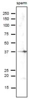 Sperm equatorial segment protein 1 antibody, GTX00750, GeneTex, Western Blot image 