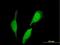 SEC23-interacting protein antibody, H00011196-B01P, Novus Biologicals, Immunofluorescence image 
