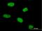 Centromere Protein V antibody, H00201161-B01P, Novus Biologicals, Immunocytochemistry image 