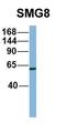 Protein SMG8 antibody, orb326150, Biorbyt, Western Blot image 