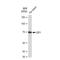 E2F-1 antibody, GTX09015, GeneTex, Western Blot image 