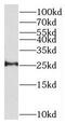 Thioesterase Superfamily Member 4 antibody, FNab08663, FineTest, Western Blot image 