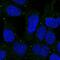 Major Facilitator Superfamily Domain Containing 3 antibody, HPA056013, Atlas Antibodies, Immunocytochemistry image 