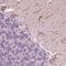 Cadherin EGF LAG seven-pass G-type receptor 3 antibody, NBP2-38975, Novus Biologicals, Immunohistochemistry frozen image 