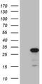 ATP Binding Cassette Subfamily C Member 5 antibody, NBP2-46467, Novus Biologicals, Western Blot image 