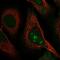 Ribosomal Biogenesis Factor antibody, NBP2-57941, Novus Biologicals, Immunocytochemistry image 