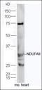 WASH complex subunit FAM21C antibody, orb2212, Biorbyt, Western Blot image 