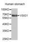 V-Set And Immunoglobulin Domain Containing 1 antibody, abx004011, Abbexa, Western Blot image 