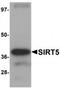Sirtuin 5 antibody, TA319855, Origene, Western Blot image 