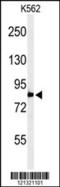 Phospholipase A2 Group IVB antibody, 61-712, ProSci, Western Blot image 
