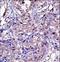 Stromelysin-3 antibody, LS-C164233, Lifespan Biosciences, Immunohistochemistry frozen image 