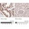 Replication factor C subunit 4 antibody, NBP2-48927, Novus Biologicals, Immunohistochemistry paraffin image 
