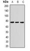 ANTXR Cell Adhesion Molecule 1 antibody, orb377921, Biorbyt, Western Blot image 