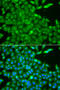 Casein Kinase 1 Gamma 2 antibody, 22-865, ProSci, Immunofluorescence image 