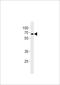 Zinc Finger Protein 90 antibody, LS-C160963, Lifespan Biosciences, Western Blot image 