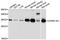 ATPase H+ Transporting V1 Subunit E1 antibody, A10806, Boster Biological Technology, Western Blot image 