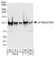 hPrt1 antibody, A301-760A, Bethyl Labs, Western Blot image 