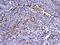Fms Related Tyrosine Kinase 4 antibody, A01276-2, Boster Biological Technology, Immunohistochemistry frozen image 