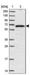 Zinc Finger SWIM-Type Containing 1 antibody, PA5-59451, Invitrogen Antibodies, Western Blot image 