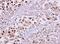 Karyopherin Subunit Alpha 2 antibody, NBP1-31098, Novus Biologicals, Immunohistochemistry frozen image 