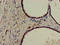 ERCC Excision Repair 4, Endonuclease Catalytic Subunit antibody, LS-C677833, Lifespan Biosciences, Immunohistochemistry paraffin image 
