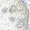 NFBD1 antibody, A8358, ABclonal Technology, Immunohistochemistry paraffin image 
