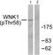 WNK1 antibody, PA5-38095, Invitrogen Antibodies, Western Blot image 
