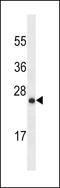 LY6/PLAUR Domain Containing 6B antibody, LS-B9945, Lifespan Biosciences, Western Blot image 