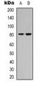 Neuregulin 3 antibody, orb339150, Biorbyt, Western Blot image 